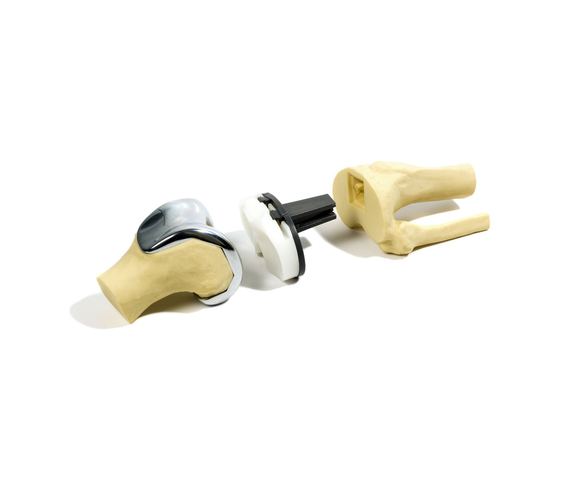 Prótese de Joelho